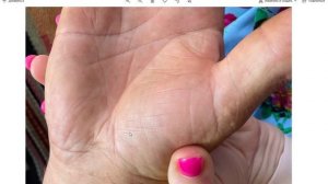 Здоровье на руке, инсульт, разрыв на линии жизни. Хиромантия/Василиса Дождь