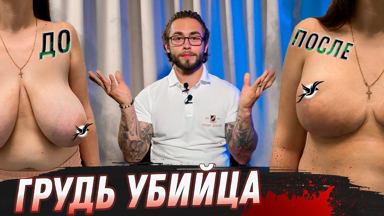 УМЕНЬШЕНИЕ ГРУДИ РЕДУКЦИОННАЯ МАММОПЛАСТИКА смотреть онлайн