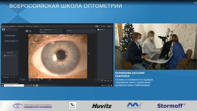 Основы и особенности подбора торических линз с различным дизайном зоны стабилизации. смотреть онлайн