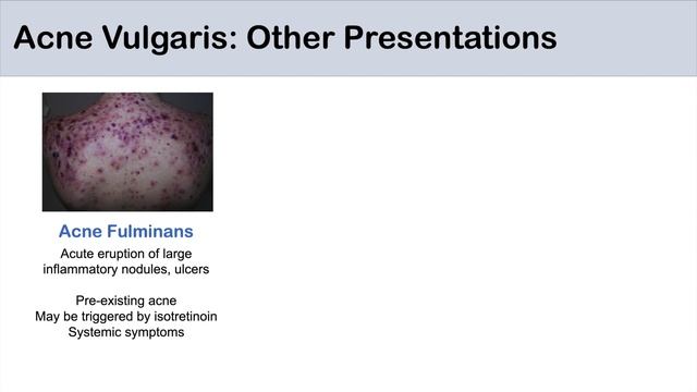 Acne Vulgaris | Causes, Pathogenesis, Influencing Factors, Diagnosis, Treatment and Complications смотреть онлайн