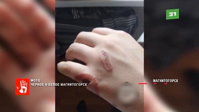 Девушку наказали за кражу, облив кислотой смотреть онлайн