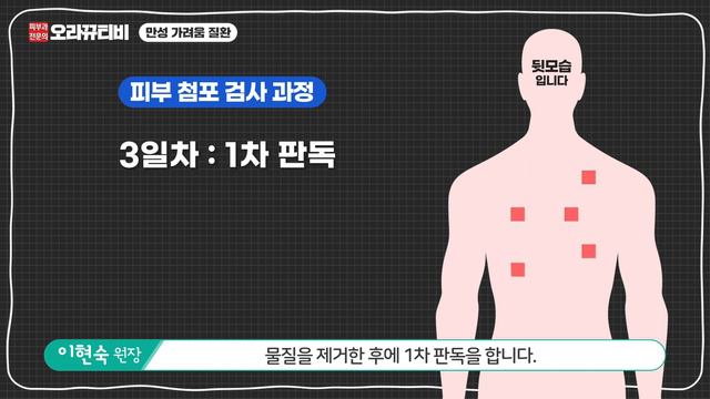 (sub)가려움증이 너무 오래 지속된다면? 만성 가려움증의 원인찾기! 진료와 치료까지! смотреть онлайн