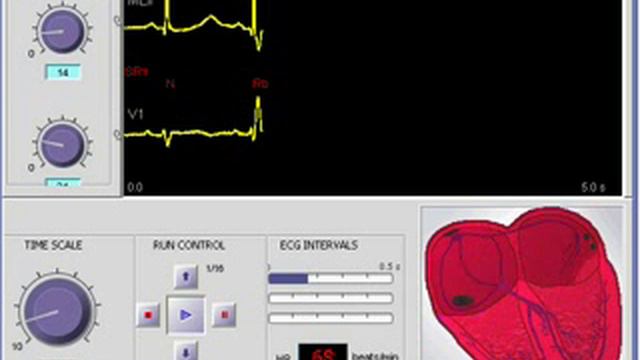еще раз об экг