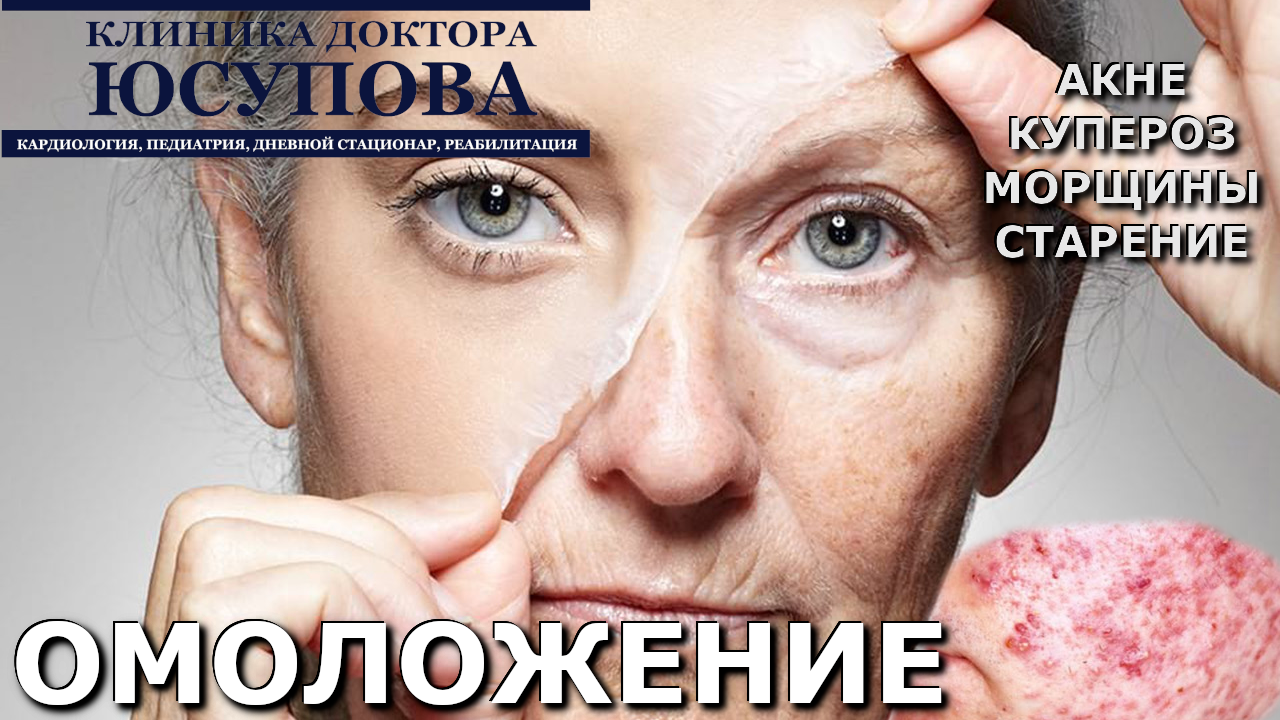 Омоложение, акне, купероз, морщины, иглоукалывание, иглотерапия, кожные заболевания, омоложение лица