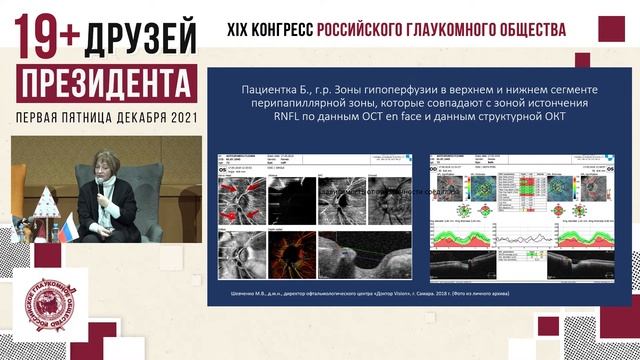 Урок 14. Глаукома и миопия: точки соприкосновения в клинической практике смотреть онлайн