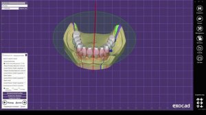 20. Моделирование полного съемного протеза
