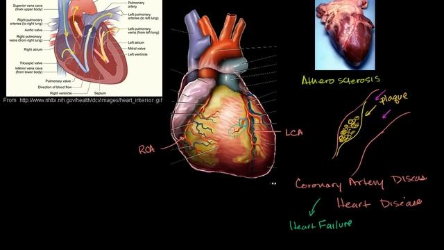 Heart disease and heart attacks | Miscellaneous | Heatlh & Medicine | Khan Academy смотреть онлайн