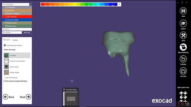 Розбірна коренево-культьова вкладка в Exocad смотреть онлайн