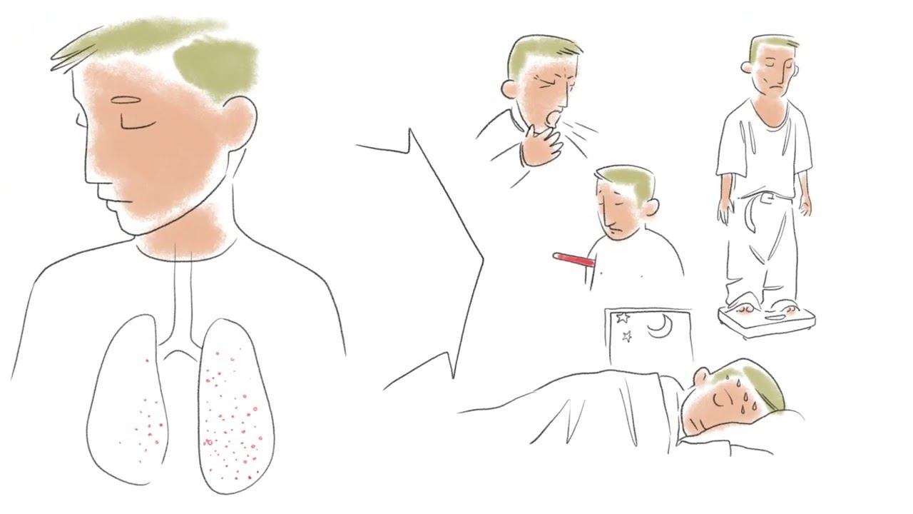 Видеоролик о профилактическом лечении латентной туберкулезной инфекции смотреть онлайн
