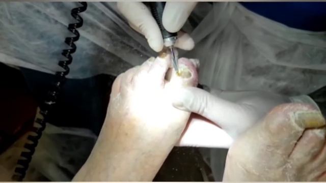 Выезд на дом за 140 км. Пациентка 93 года смотреть онлайн