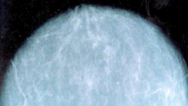 Slowing the Growth of Cancer смотреть онлайн
