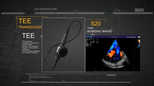 SonoScape S20 - УЗИ аппарат среднего класса | uzimir.ru