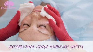 Нити Аптос Визаж. Установка нитей Аптос