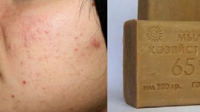 В чем секрет хозяйственного мыла смотреть онлайн