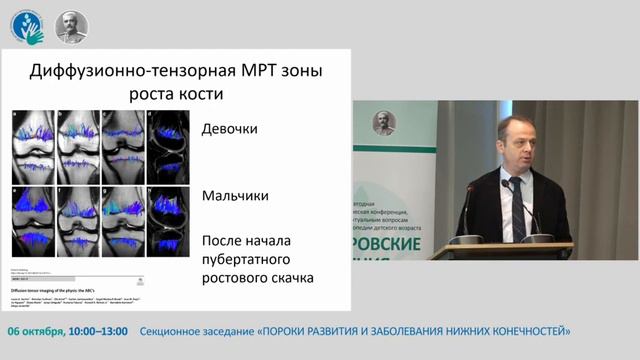 Диффузионно-тензорная МРТ как потенциальный методисследования ростковых зон кости. смотреть онлайн