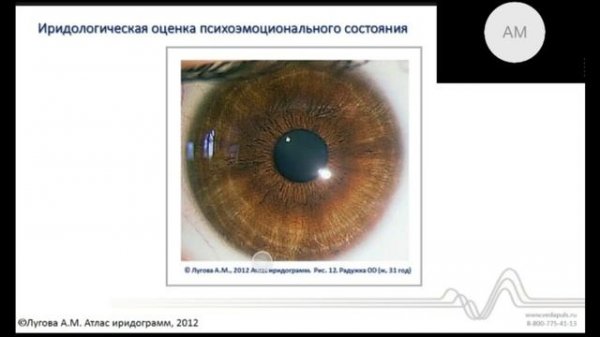 Практическая иридодиагностика