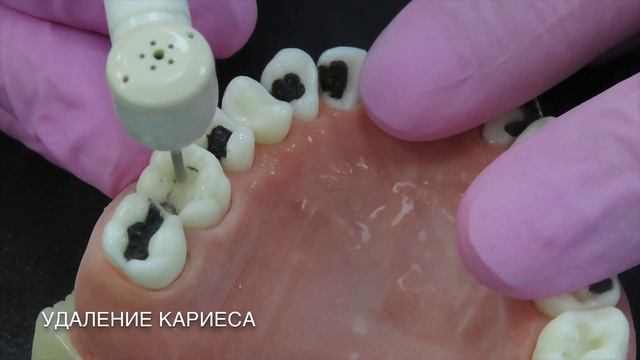 "ЛЕОНАРДО" - гибридный стоматологический симулятор 🦷✅🧑🏻 смотреть онлайн