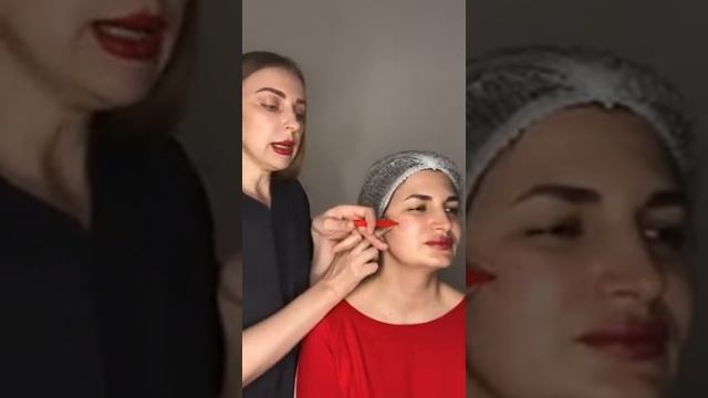 Средняя треть: игла или канюля. Анатомический аспект смотреть онлайн