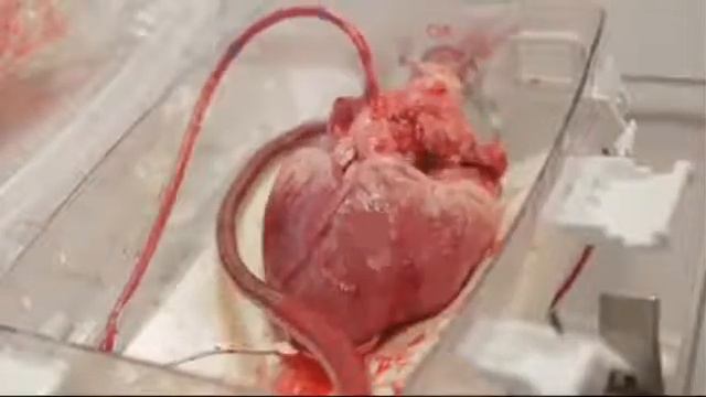 Saddam 197. My Hart bet sum one 76808029 смотреть онлайн