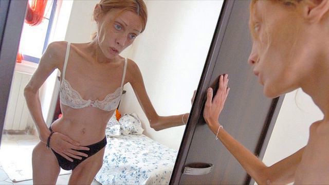 Симптомы анорексии