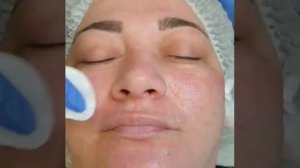 BB GLOW проведение процедуры