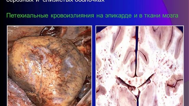 13:50 Нарушения гемодинамики смотреть онлайн