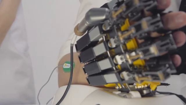 Рука Надежды   Реабилитация после инсульта Hand Of Hope