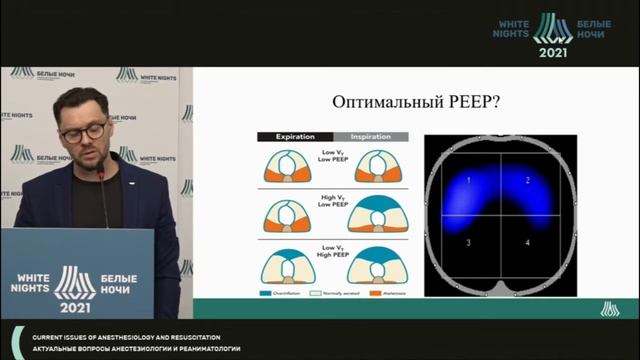 Искуственная вентиляция легких у пациентов с морбидным ожирением смотреть онлайн