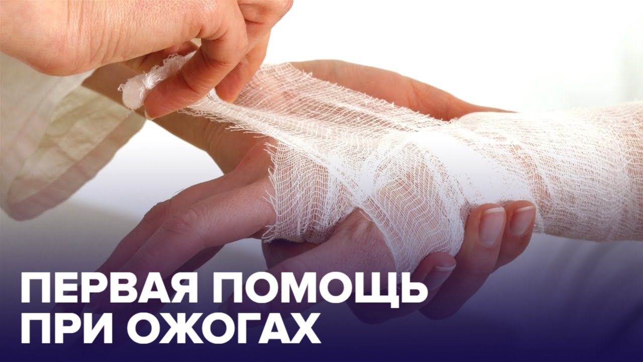 Первая помощь при ОЖОГАХ: как ее оказывать? смотреть онлайн