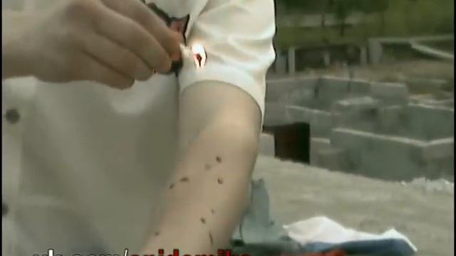 EpiDemiks - Эпиляция смотреть онлайн