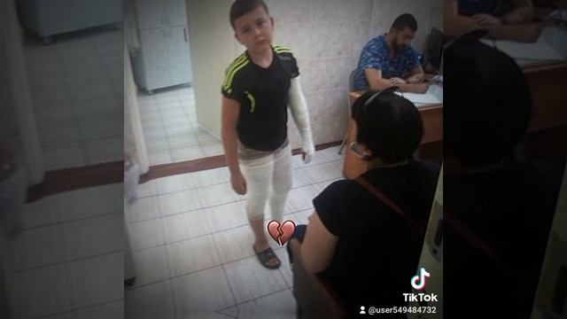 я горел в пожаре