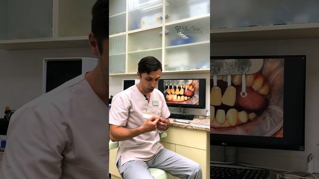Как выбрать цвет виниров? Отвечает стоматолог-ортопед NKclinic