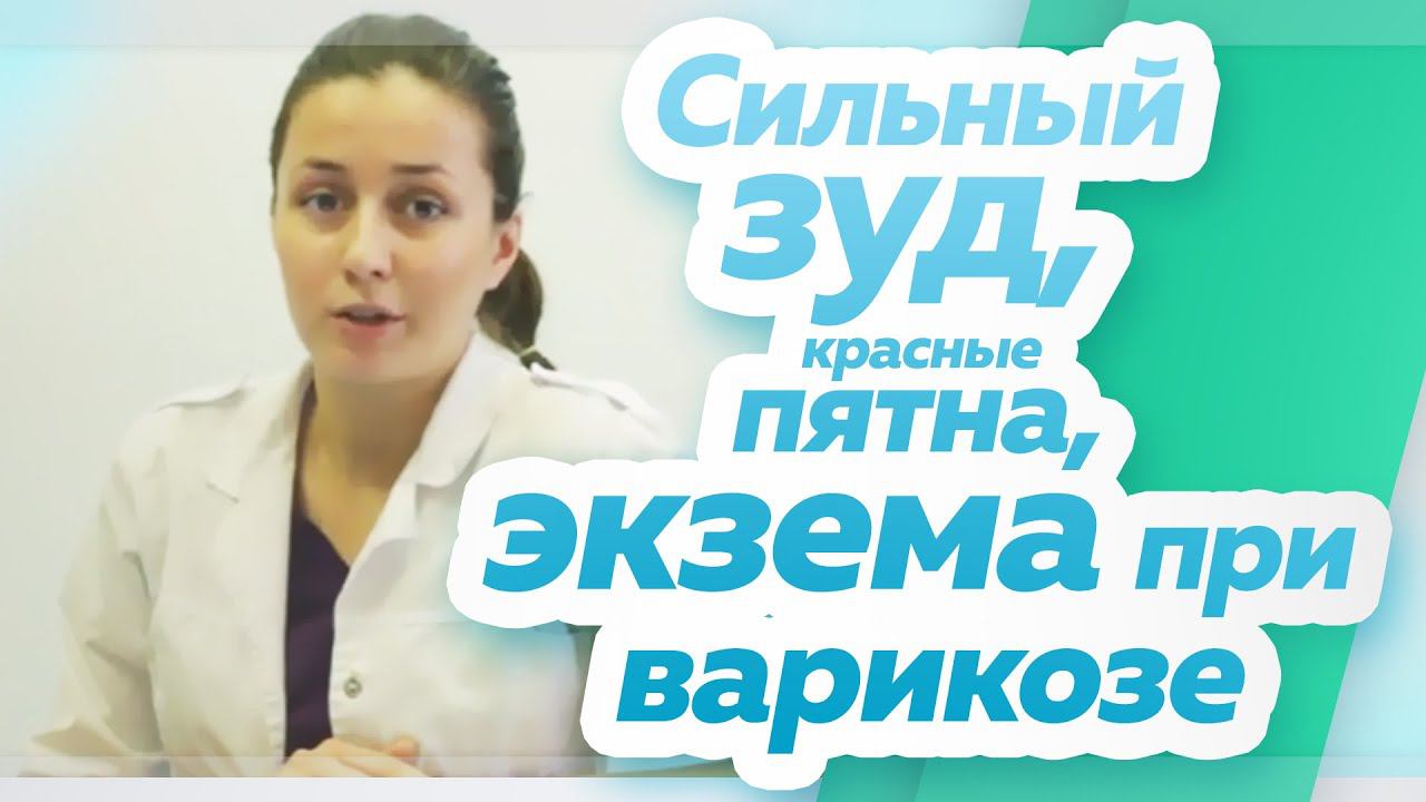 Сильный зуд на ноге, красные пятна, экзема при варикозном расширении вен смотреть онлайн