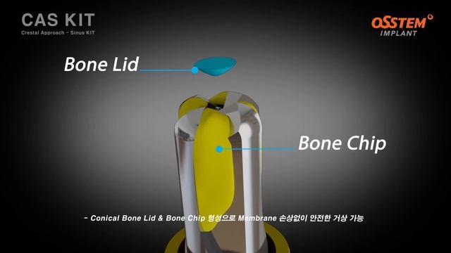 CAS KIT. Ознакомление с набором смотреть онлайн