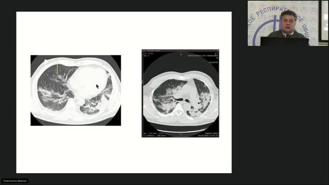 Конференция "Проблемы и решения в респираторной медицине", г. Оренбург, 2 октября 2021 года смотреть онлайн