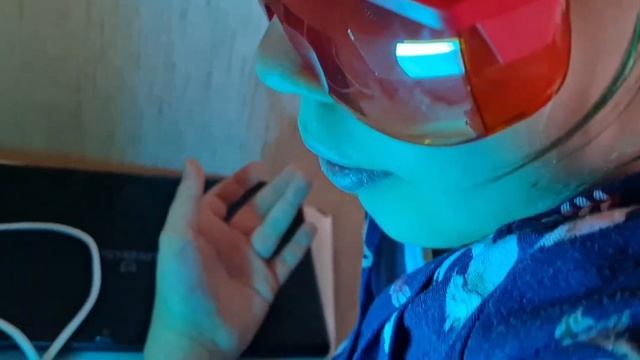 Домашний кварцевый облучатель. Реабилитация функций руки при переломе со смещением. смотреть онлайн