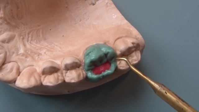 Dental Wax Up Molar 16: In-Depth Waxup Tutorial For Dental Study
