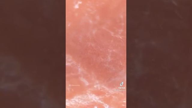 Рука человека под микроскопом смотреть онлайн