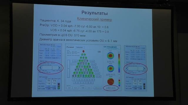 Современные возможности эксимерлазерной коррекции. Солодкова Е.Г. (Волгоград) смотреть онлайн