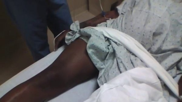 Captain Morgan Reduction Dislocated Hip