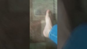 перелом пятки, через три месяца. Как зажило, проблемы с обувью.