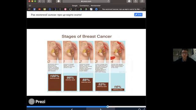 81st LYSICon: «Рак молочної залози: про це варто знати», Маркіян Фецич смотреть онлайн