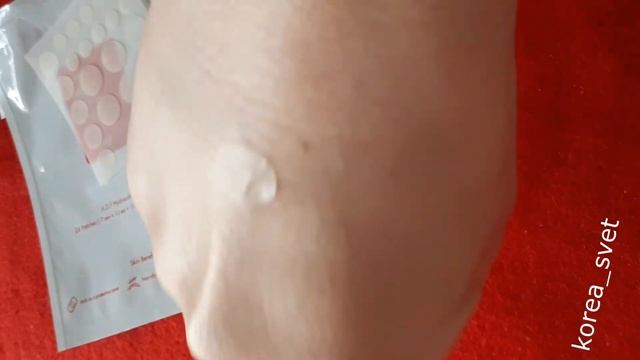 Обзор патчей от прыщей корейского бренда Cosrx Acne Pimple Master Patch