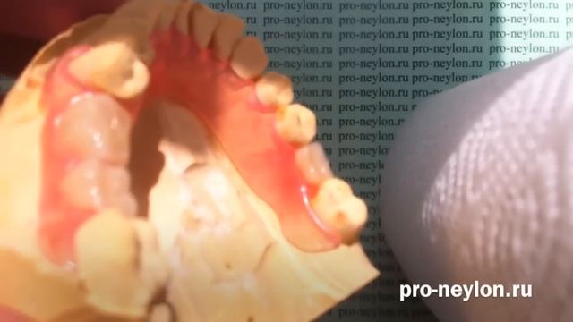 Нейлоновые протезы -  Nylon Prosthesis