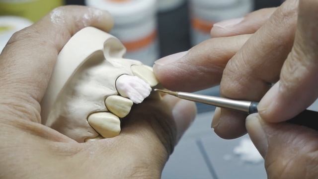 IPS Classis, el CLASSICO de siempre que prevalece en el tiempo | Ivoclar смотреть онлайн