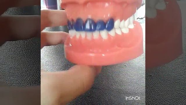 Моделирование фронтальных зубов. смотреть онлайн