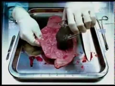 ОБЩЕЕ ДЕЛО Внутренняя сторона курения