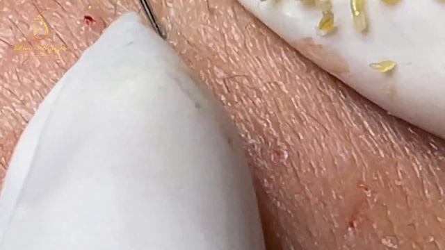 Satisfying With Loan Nguyen Spa Video #012 смотреть онлайн
