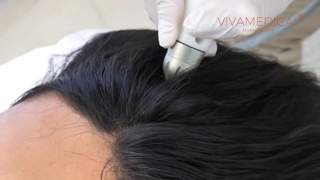 Мезотерапія шкіри голови Dermadrop SHINE & GLOW в клініці Vivamedical смотреть онлайн