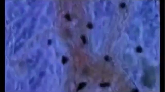 Как на самом деле бороться со свободными радикалами смотреть онлайн